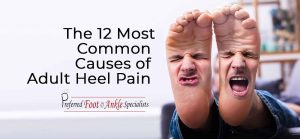 Common causes of heel pain in adults