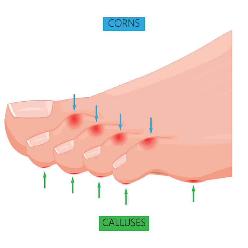 Popular Podiatry Myths